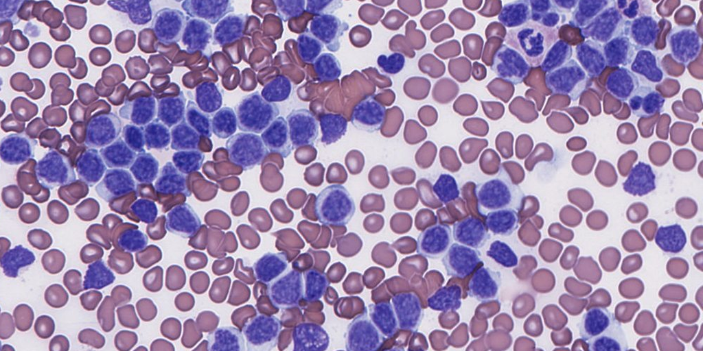 Automated Blood Cells Analysis