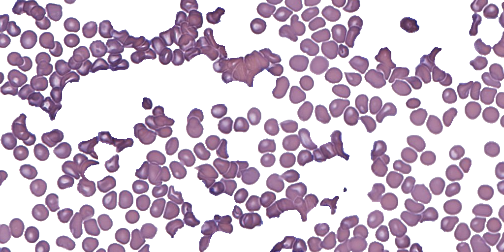 Patch-level Platelets Segmentation